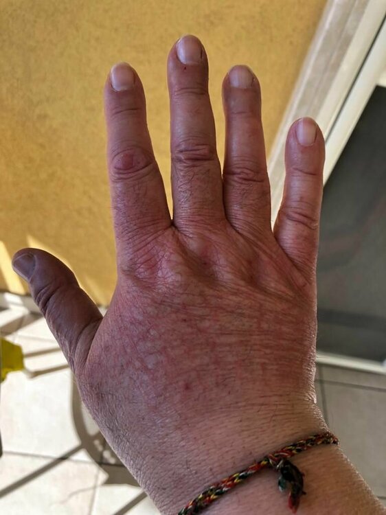 Mano Dx.jpg