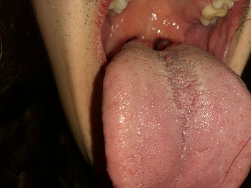 IMG-20220302-WA0003.thumb.jpg.6fb42ab6073ec4669b527703b54dce42.jpg