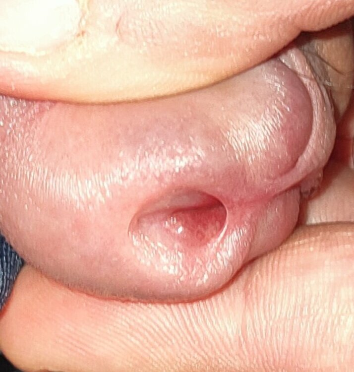 IMG_20220311_185751.jpg