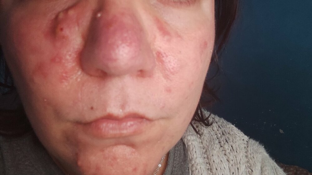 IMG_20220314_113720.jpg