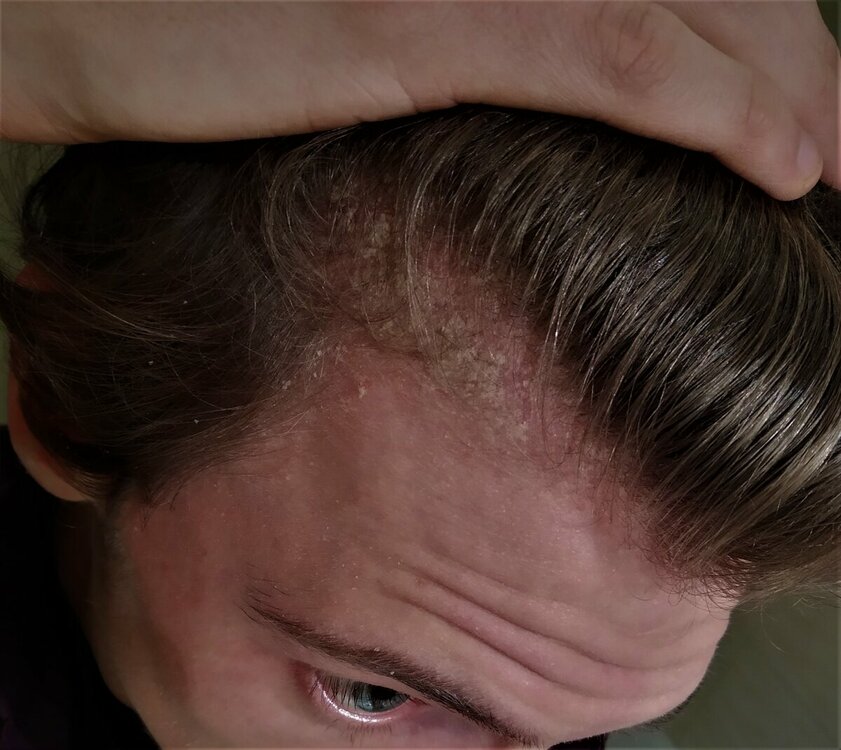 pelle1.jpg