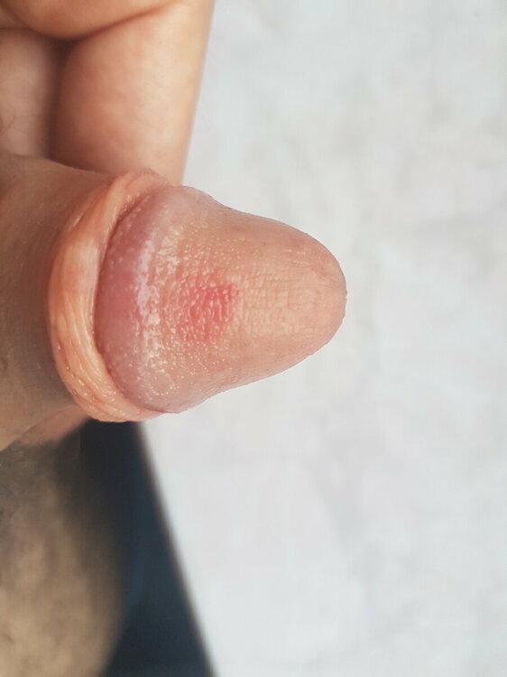 16551411349468427887117459745209.thumb.jpg.acb151dd4ff2527a42fdb0a45022d981.jpg