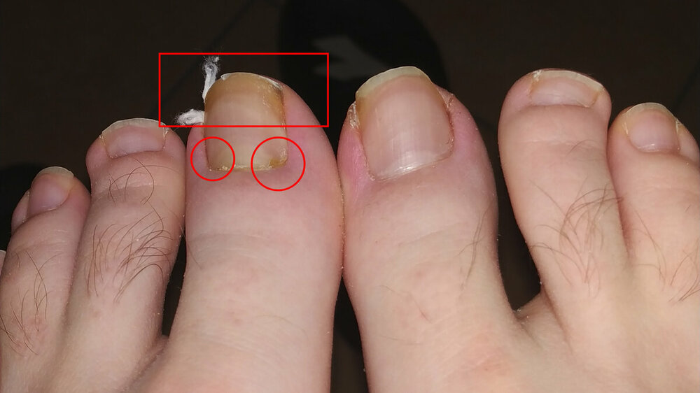 Piedi.jpg