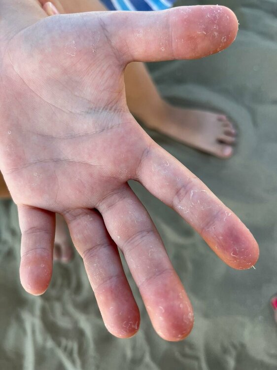 foto mano sx.jpeg