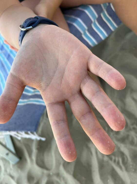 foto mano dx.jpeg