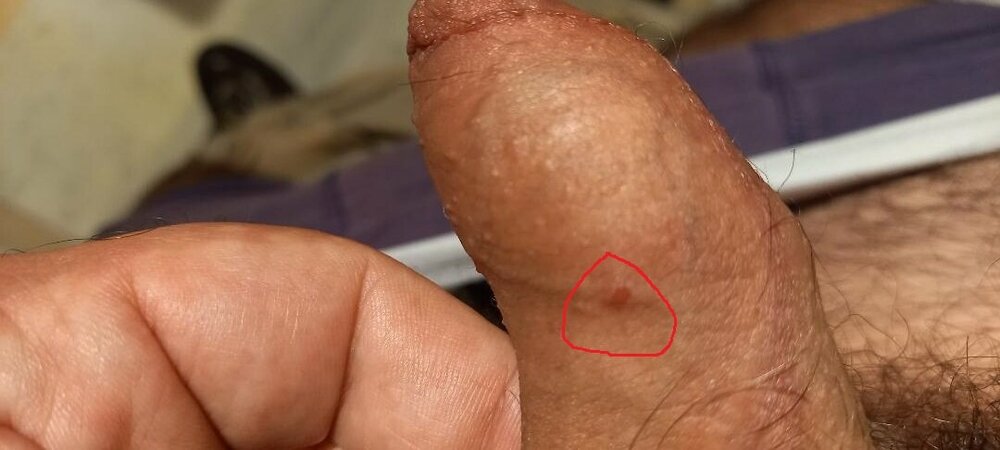thumbnail.jpg