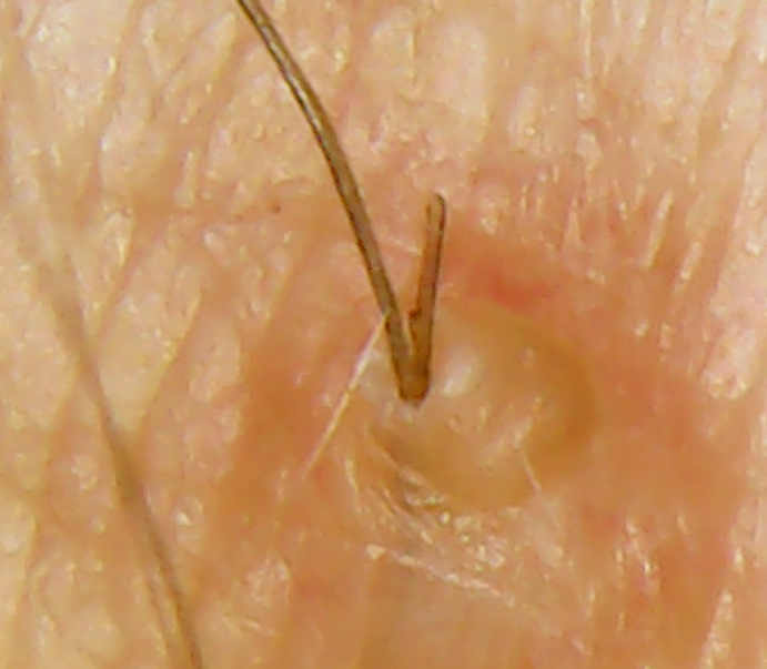 arm_r.png.b59d0a604073e26054535fd4bfaaf229.png