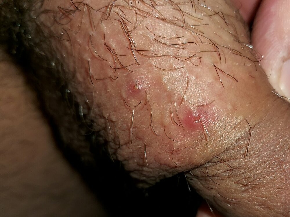 20221017_105703.thumb.jpg.2cb6f530af6e7b166a99449444d24aac.jpg