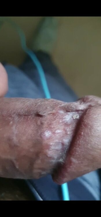 Screenshot_20221020-175652_Gallery.thumb.jpg.25aa6ed69d2780e339a828873db35945.jpg
