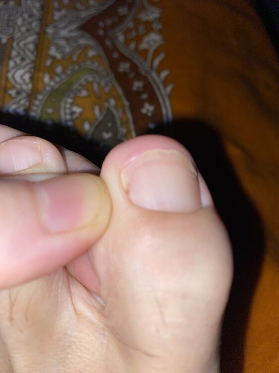 11951009-31BD-42D0-96BB-DEB8D2C7C3D6.thumb.jpeg.a5f75871aedac9d1f8c7e623f8cf8a08.jpeg