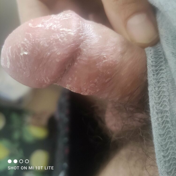 16681604677186768174831997987603.thumb.jpg.4453e3337e9c2124089da42950150823.jpg