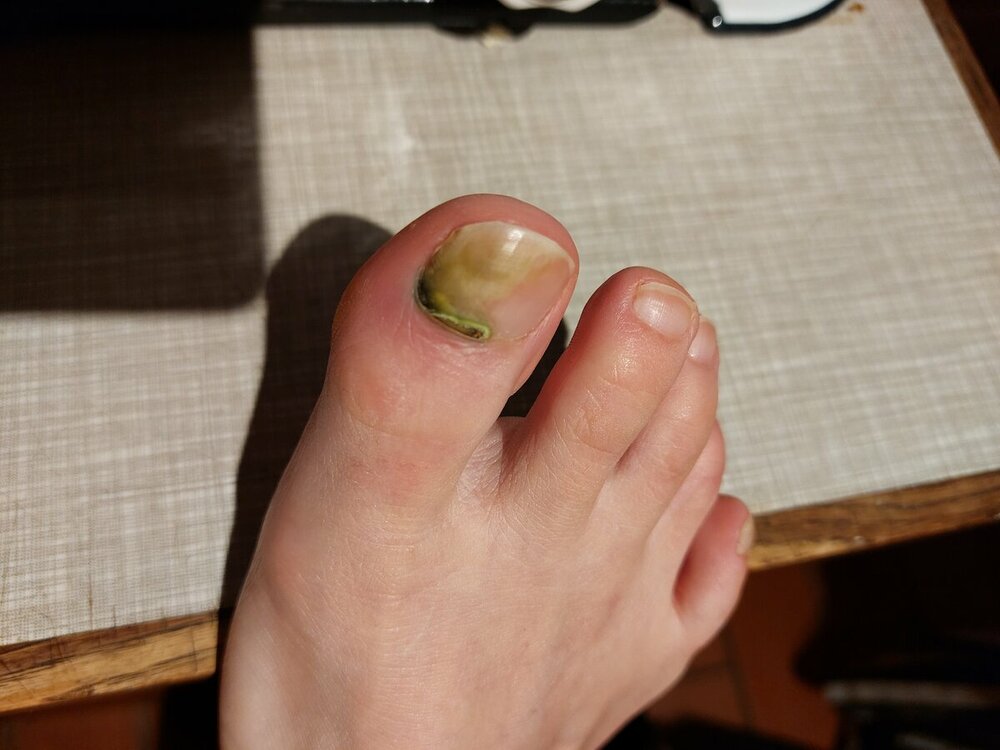 20221102_185943.thumb.jpg.b1fa6220cf5e42abe9089def6f51b01a.jpg
