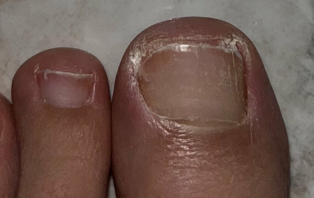 CF7B59BF-E9E0-4B6A-9B6A-D21DC4A2BD3C.thumb.jpeg.667fd05b20ee74d8a4d914f023a328af.jpeg