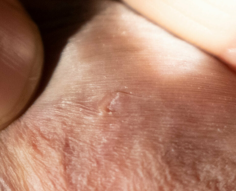 pene-03.jpg