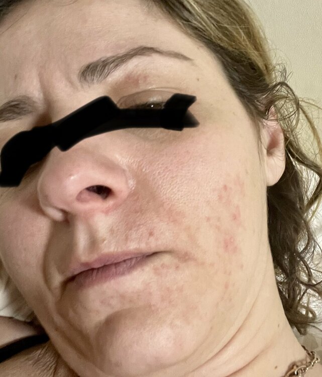 161182E4-A72F-4287-BB4A-EA89D37E533C.thumb.jpeg.2e1754bb561673109bbf7259b76a1d73.jpeg