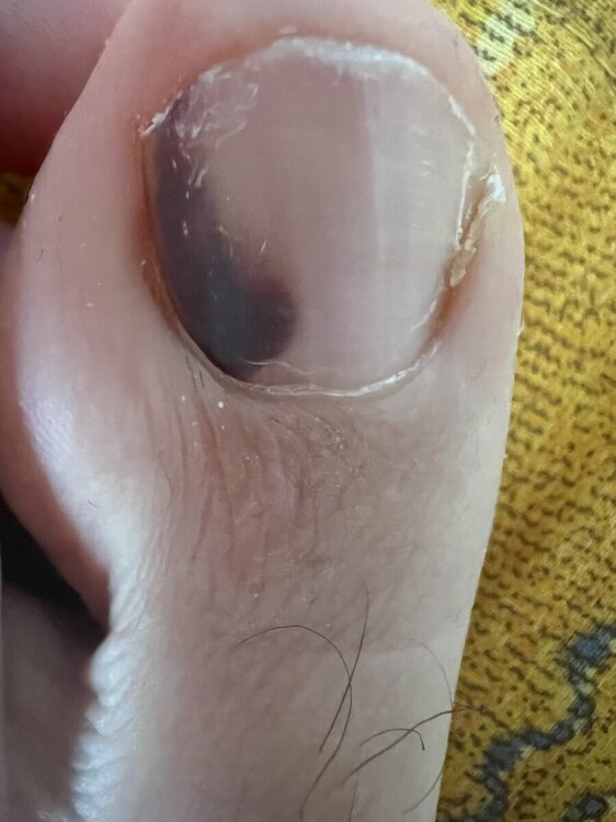 A1CBF407-F21B-4EF1-A7C4-371B2A017E94.thumb.jpeg.29258a3e1b4db57ff2bd2e3e722bceaf.jpeg