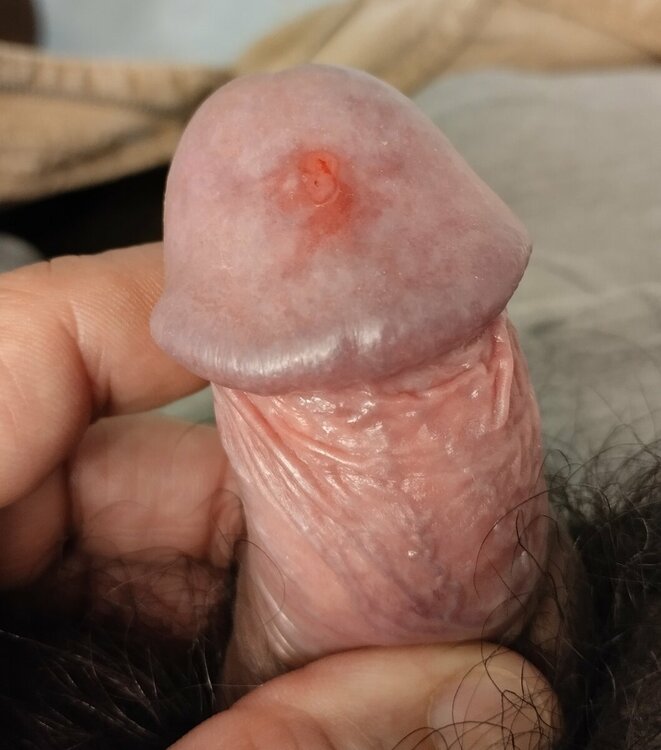 glande.jpg