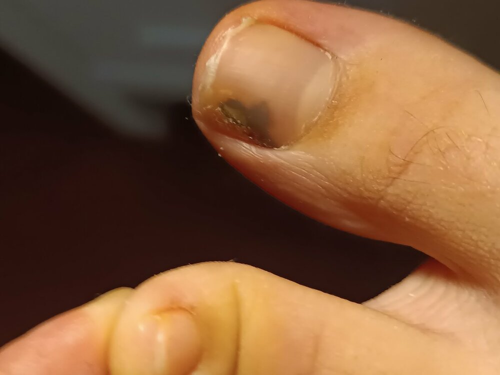 16782214489264533389840496318498.thumb.jpg.e2d28913e8688367e47bc0f949fa686c.jpg