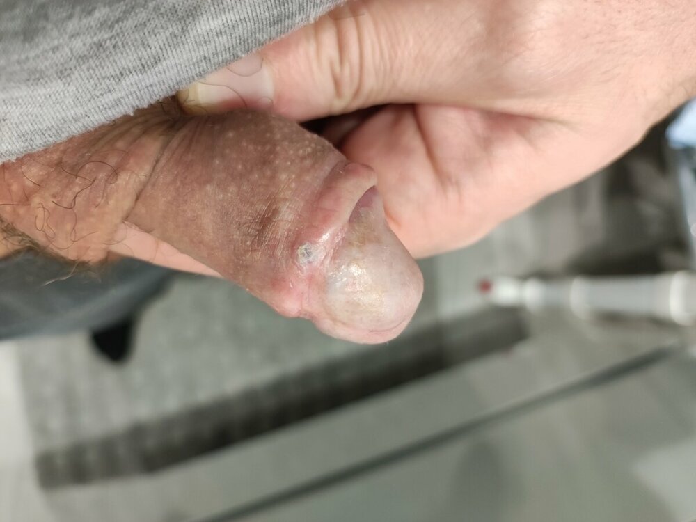 16786658846254207980057192850623.thumb.jpg.c1c5612c0f39f96835de9c4a60f443c5.jpg