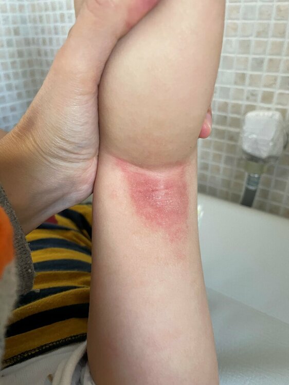 foto dermatite.jpg