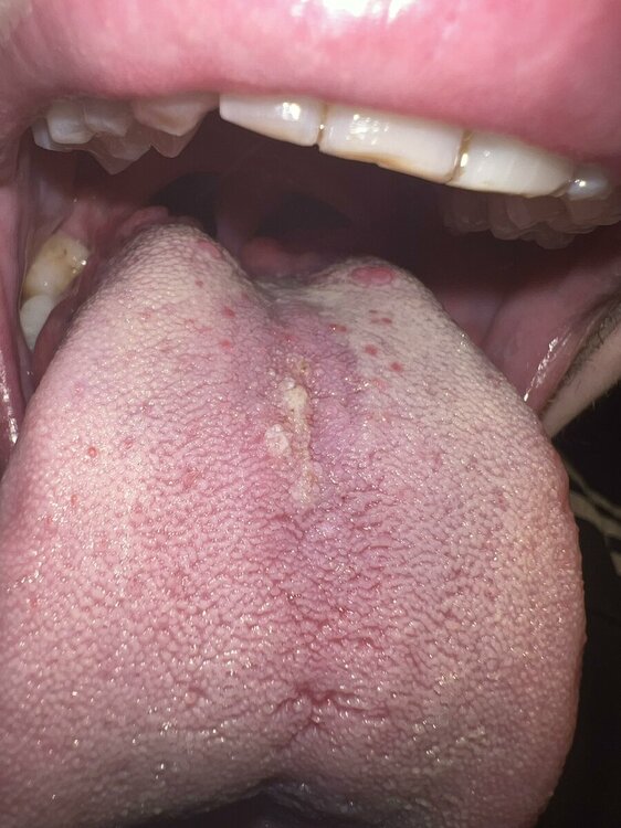 cortisone_miconazolo.thumb.jpg.d7bf33e48887f4959f1b362ef8d2c3db.jpg