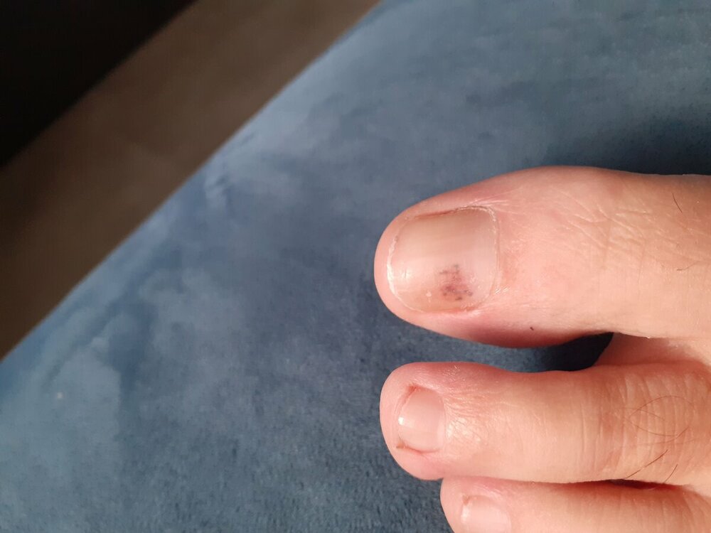 16849496676257990750950706577557.thumb.jpg.1fdc6cf23fdff3fe65e9899cb17e0a46.jpg