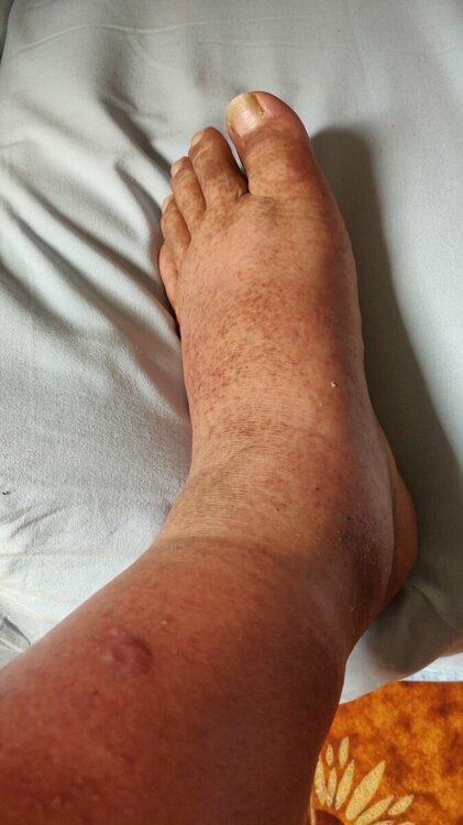 piede1.thumb.jpeg.335db5ea60840fbdcf472781e3c7ac75.jpeg