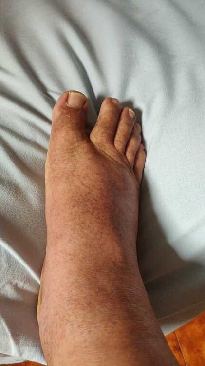 piede2.thumb.jpeg.bef3377b92df9e4a761827c154a7f33d.jpeg