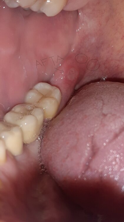Prova.thumb.jpg.7384271e6eb54b6ba5c3cb62077a3998.jpg