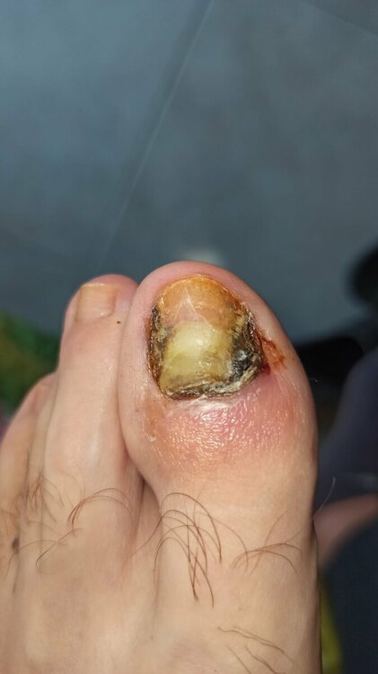 e7c9bca3-39bd-42a3-9634-39db1fd7ba79.thumb.jpg.21e243b3bacb428773b5adba5e226376.jpg