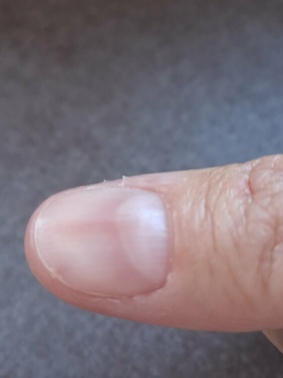 16952105490683333065261200279538.thumb.jpg.5c8c277d2d1eca62470b93aecbb9a2a2.jpg