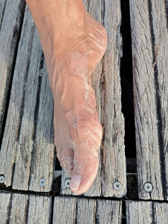 piedi prima.jpeg