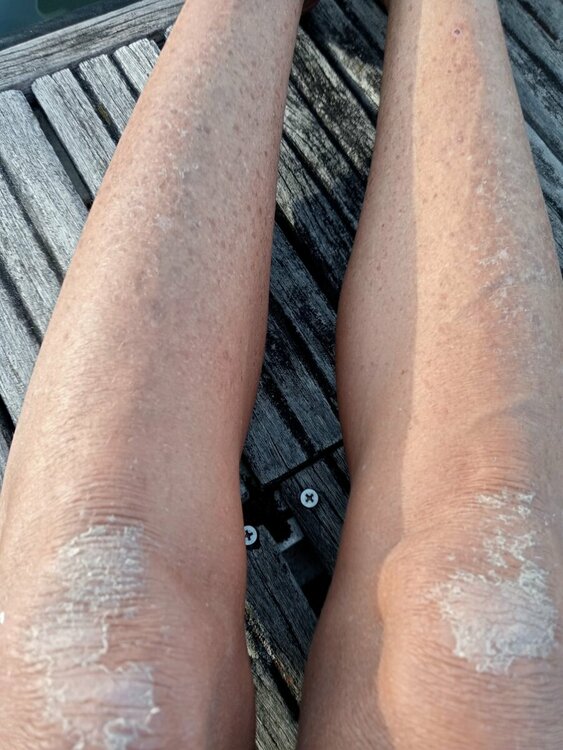 gambe ginocchia prima.jpeg