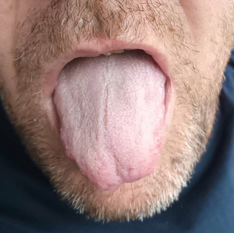 20230922_174911.thumb.jpg.8fc701a5a3866ba6d697db7e4a04b84e.jpg