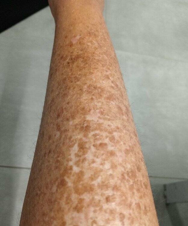 gambe ora.jpg
