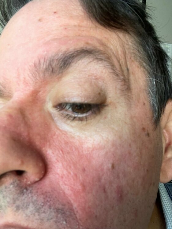derma1.jpg