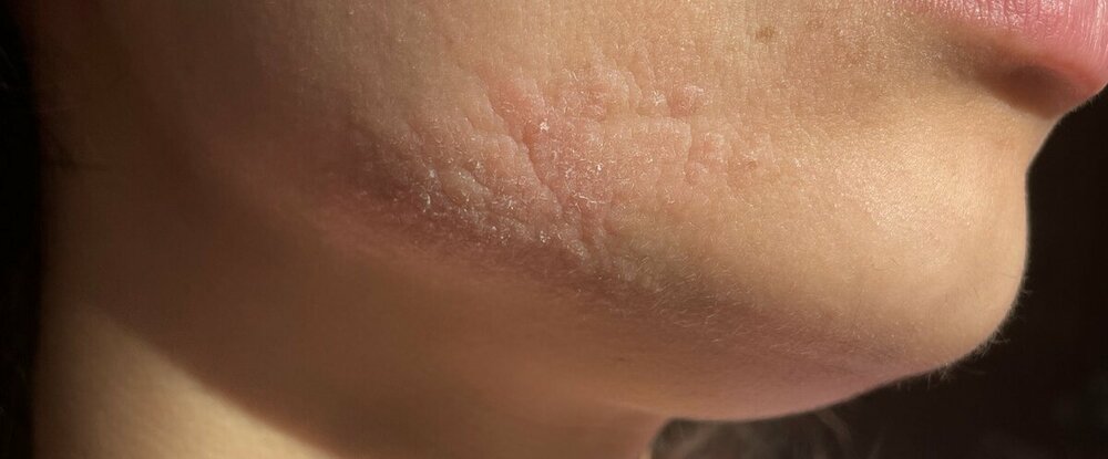 unnamed.thumb.jpg.951b3971dd245de6117651d7f73ced8e.jpg