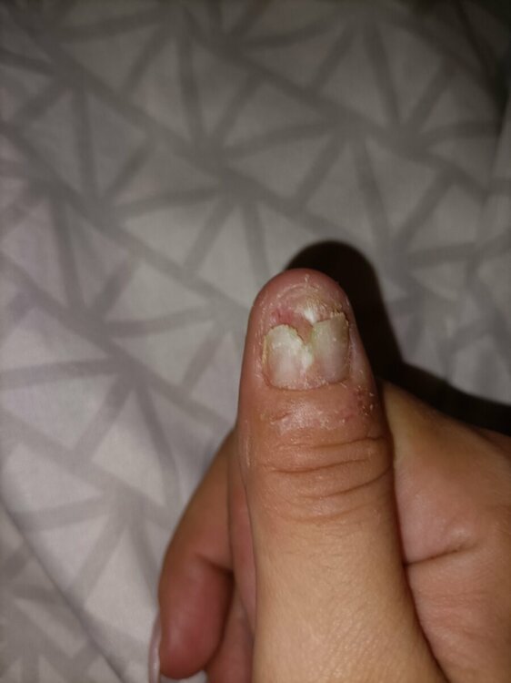 16977507516105604708735530827659.thumb.jpg.6d534f43cc1a4a17a8c064ca6d4662ed.jpg