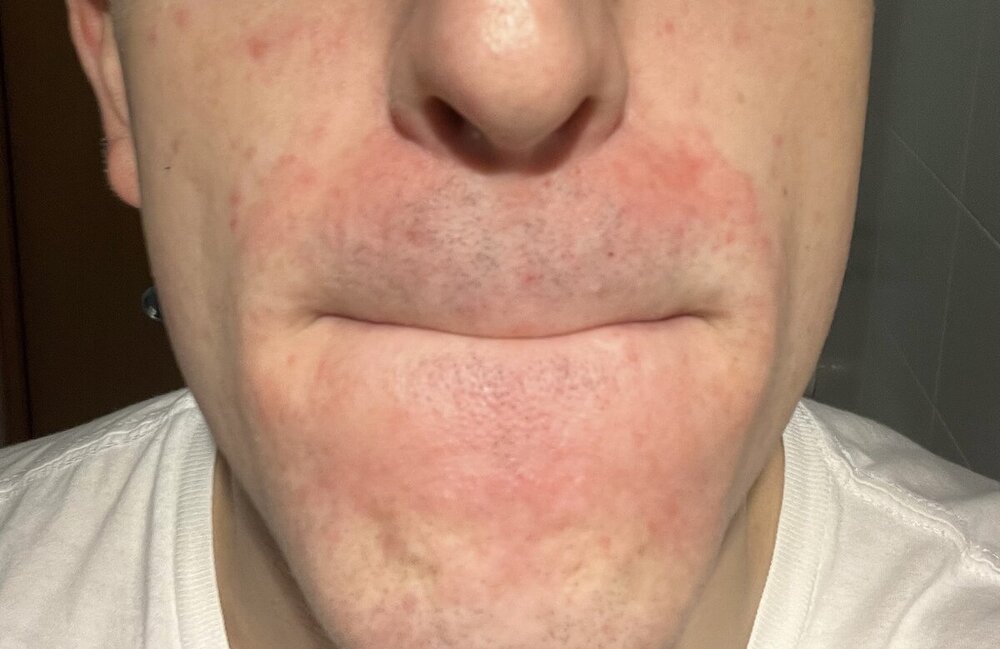 doponizoral.jpg