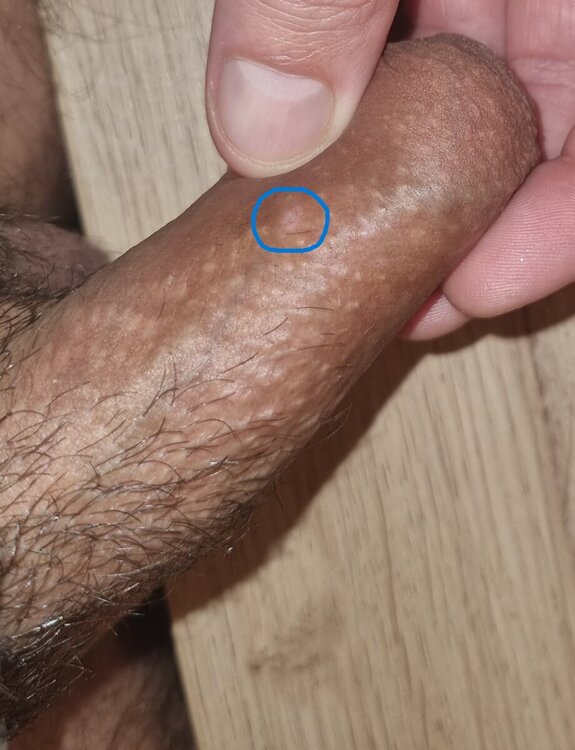 granuli1.thumb.jpg.21d82118cdb338eb953439c05cd642e8.jpg