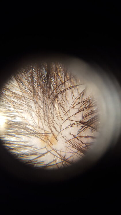 1 dermatoscopio più cellulare.jpg