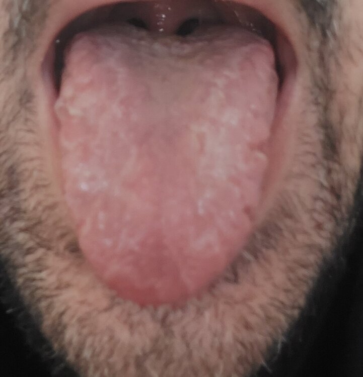 20240121_094544.jpg