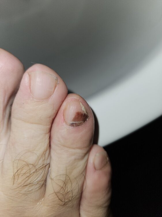 935979060_unghiapiededestro.thumb.jpg.a2444dd5b7a9d449c720114f0121d117.jpg