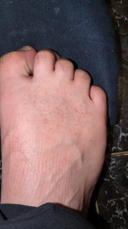 17071735943946984209522468955295.thumb.jpg.e8e5d5461504882d6f42feb5e0714e8c.jpg