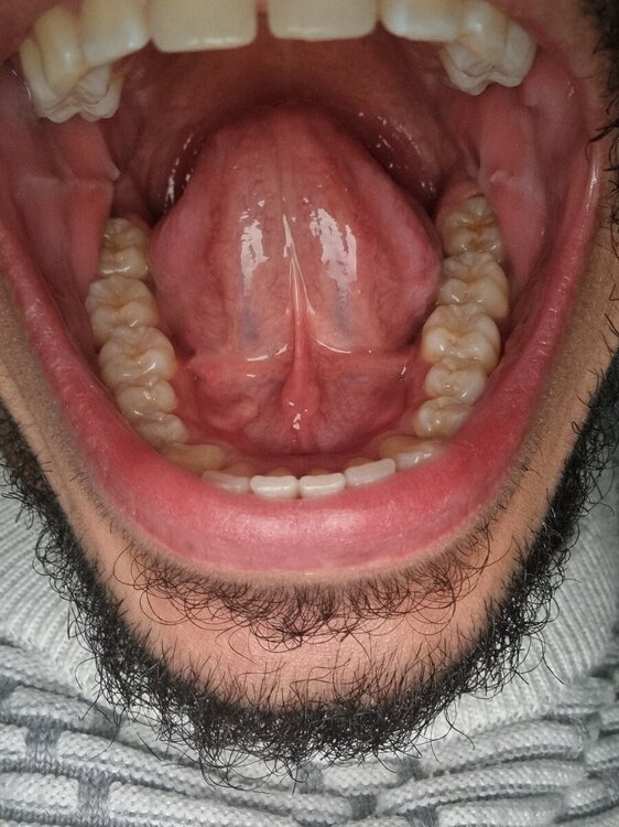 20240225_164155.thumb.jpg.8bdc9d03996393dba4c962863646db20.jpg