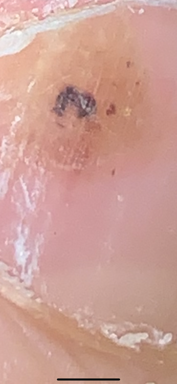D1970C0F-389C-49DF-A4A1-7770DC058E3A.png