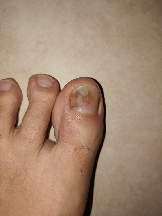 IMG20240314201359.jpg