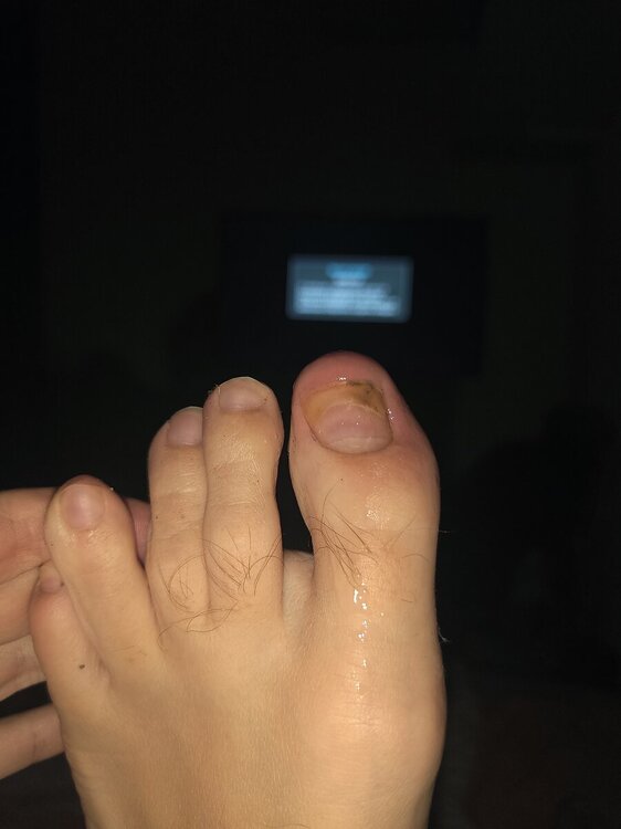 IMG20240329205310.jpg