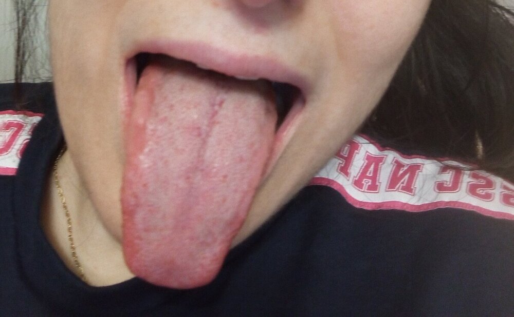 IMG_20240318_190441.jpg