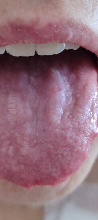 IMG_20240322_092000.jpg